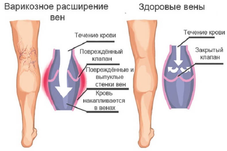 Внутривенные и внутримышечные инъекции (уколы) на дому, в клинике